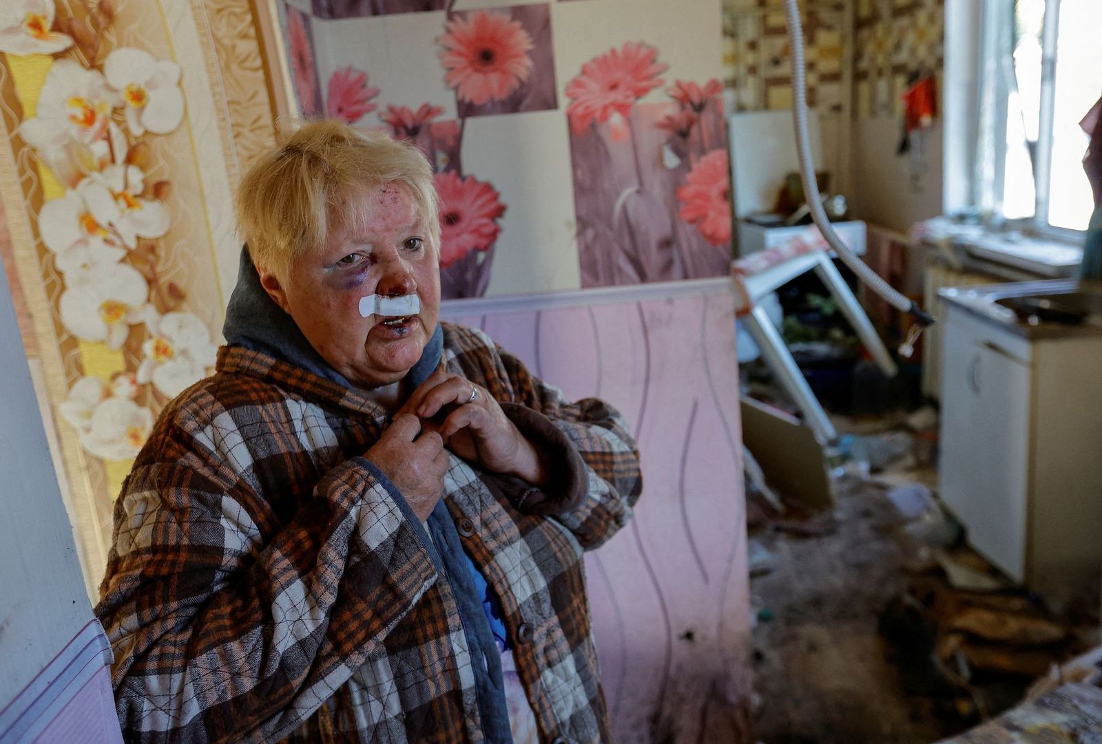 75-летняя Татьяна Герпулева, получившая ранение в результате недавнего обстрела в Донецке. 24 сентября / Reuters