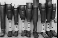 «Я не имею права вмешиваться в свои снимки». Фотографии и воспоминания Виктории Ивлевой из поездок в кризисные точки Африки, Протезы международного комитета Красного креста. Ангола, 2004 — миниатюра